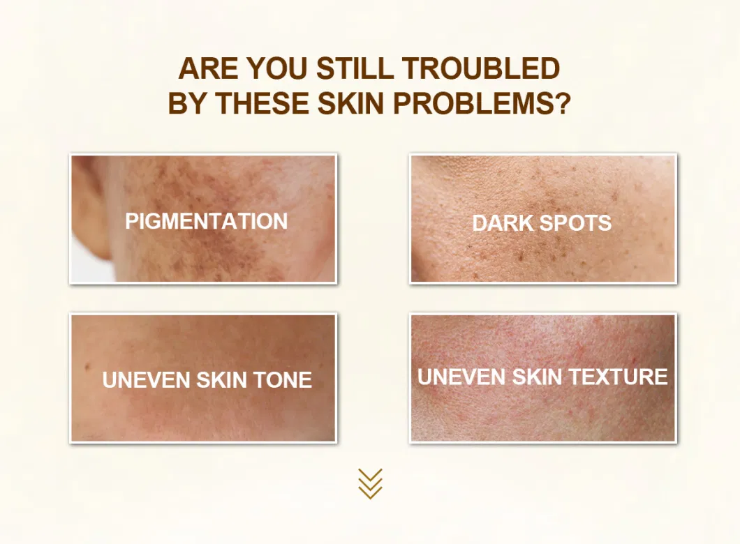 Natural Remove Dark Spot Absort Fast Lightening Skin Whitening Cream